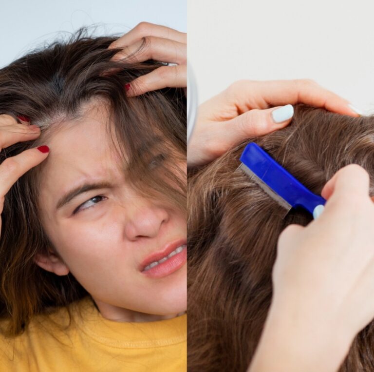 Reasons Why Scalp Hurts When Combed Or Pressed 768x763 